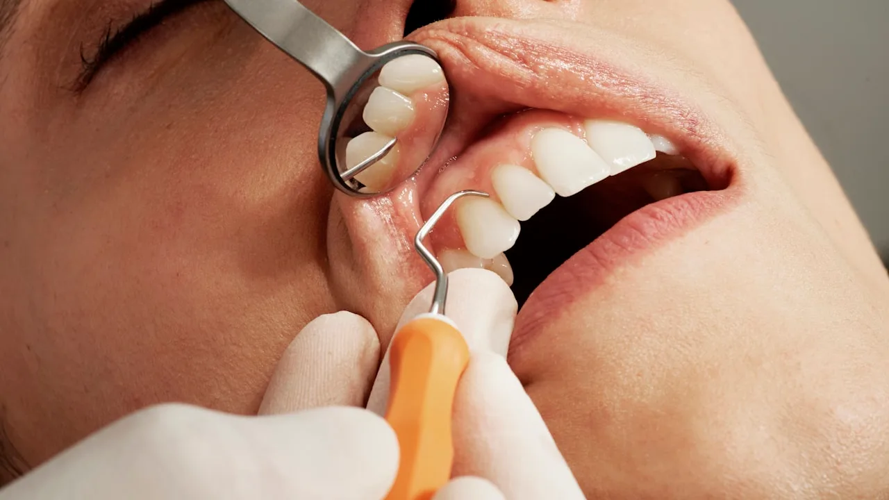 Canal dental dói? Mitos e verdades sobre o tratamento