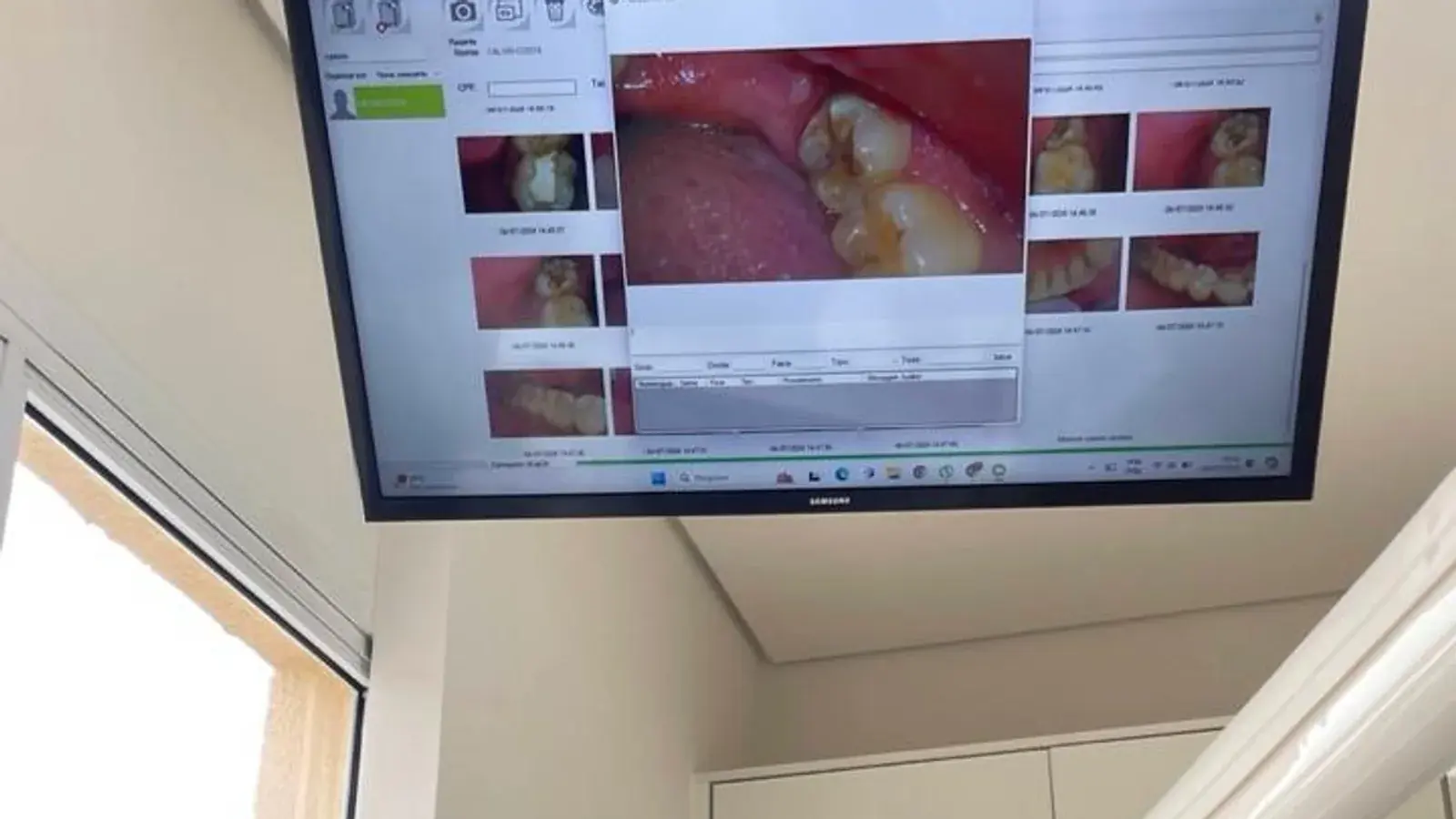 Diagnóstico odontológico em tela no consultório da 4You Odontologia